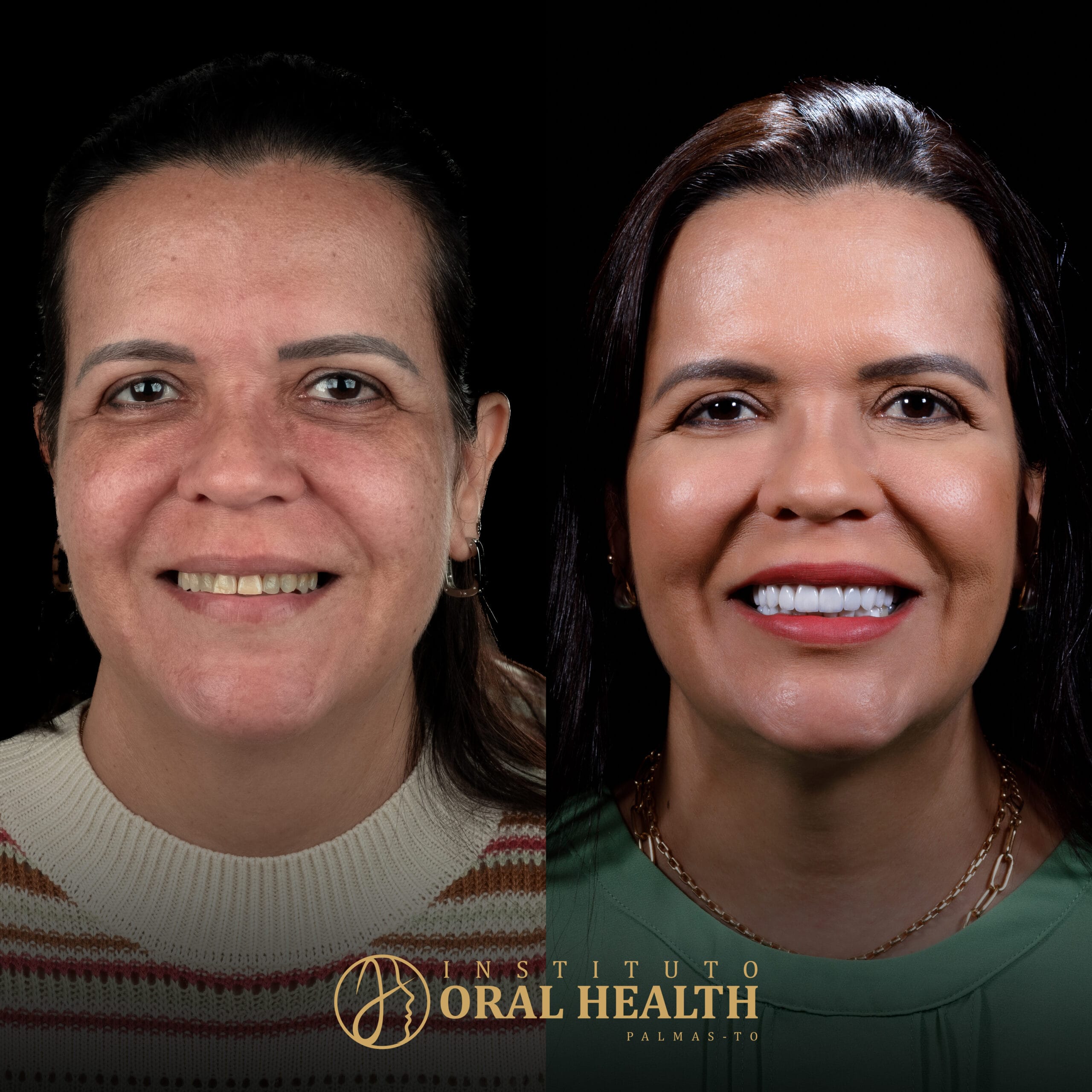 FEED ROSTO ANTES E DEPOIS 1 (1)